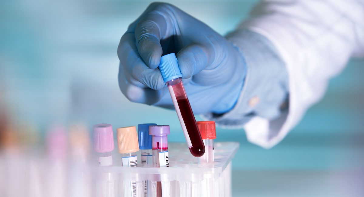hands of a lab technician with a tube of blood sample and a rack with other samples / lab technician holding blood tube sample for study